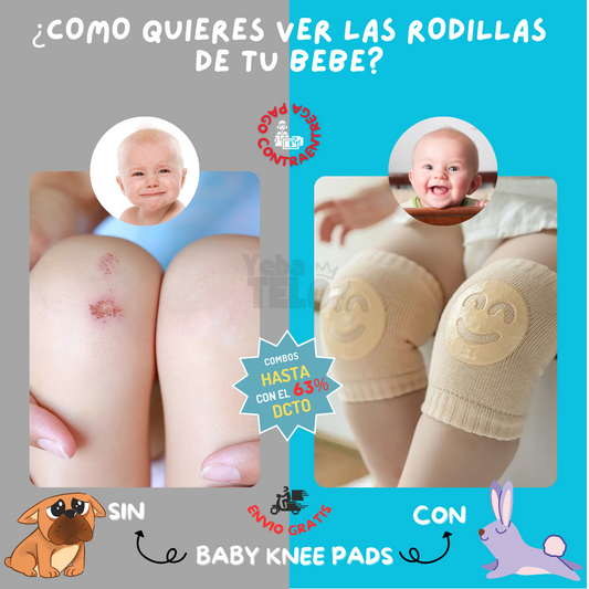 Baby Knees Pads™ | Rodilleras Antideslizantes Para Bebés👶 x3